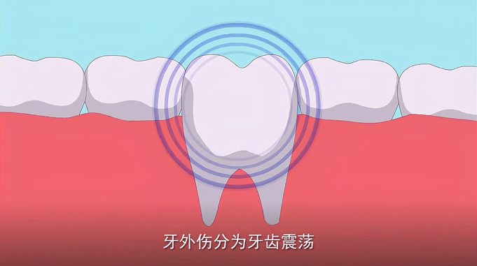 精灵爱牙讲堂之口腔健康知识：牙齿受伤怎么办？